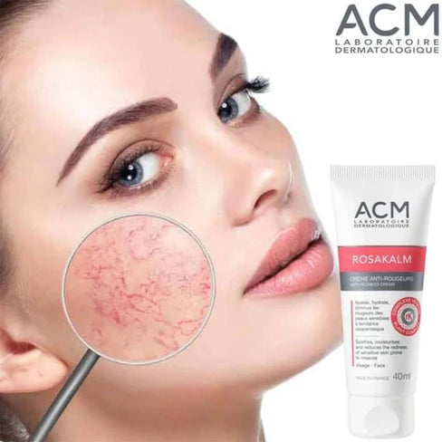 ACM